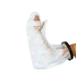 a hand with a cast on it