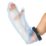 Skydd för gipsad underarm a hand with a cast on a white background